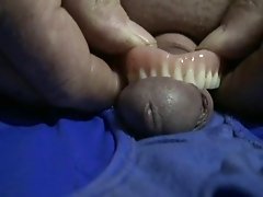 Denture Cock Bite